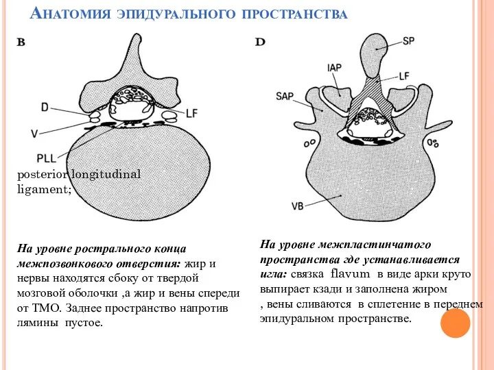 Анатомия эпидурального пространства На уровне рострального конца межпозвонкового отверстия: жир и нервы находятся