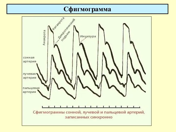 Сфигмограмма