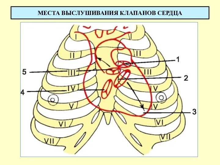 МЕСТА ВЫСЛУШИВАНИЯ КЛАПАНОВ СЕРДЦА