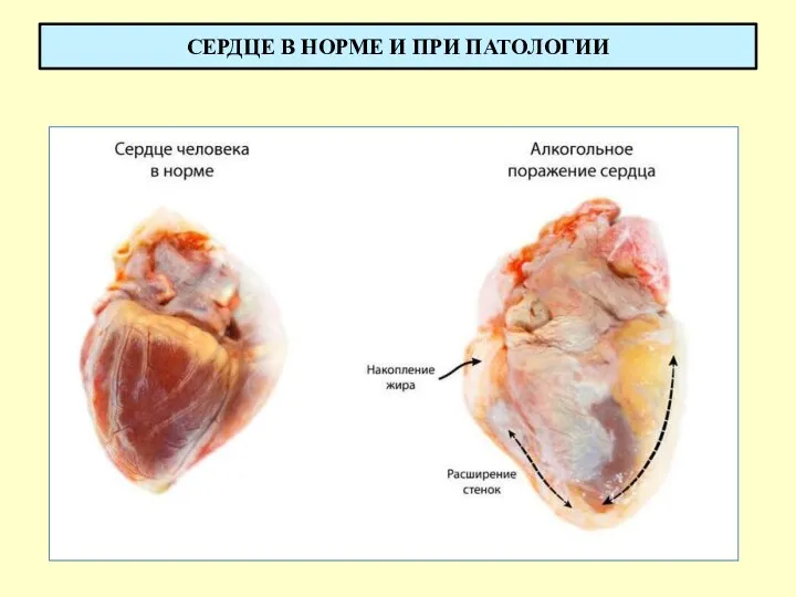 СЕРДЦЕ В НОРМЕ И ПРИ ПАТОЛОГИИ