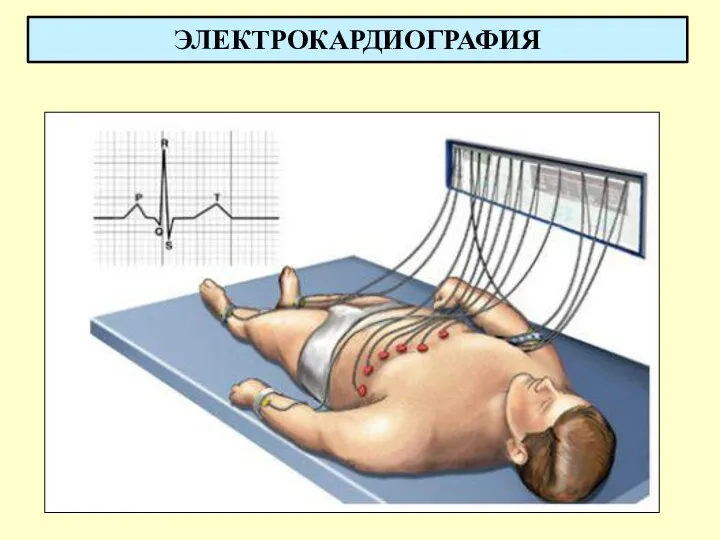 ЭЛЕКТРОКАРДИОГРАФИЯ