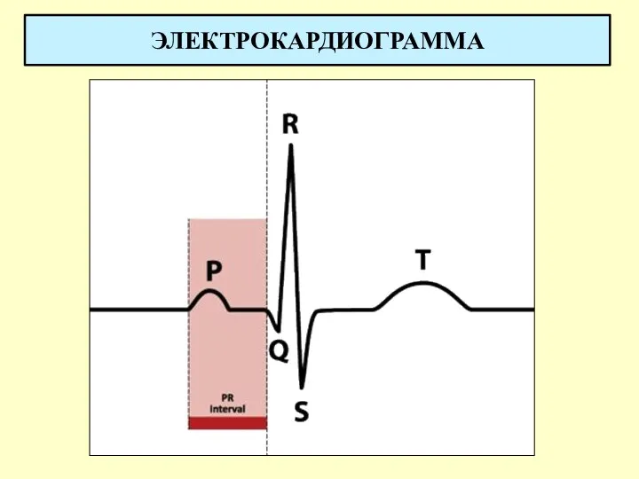 ЭЛЕКТРОКАРДИОГРАММА