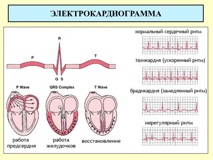 ЭЛЕКТРОКАРДИОГРАММА