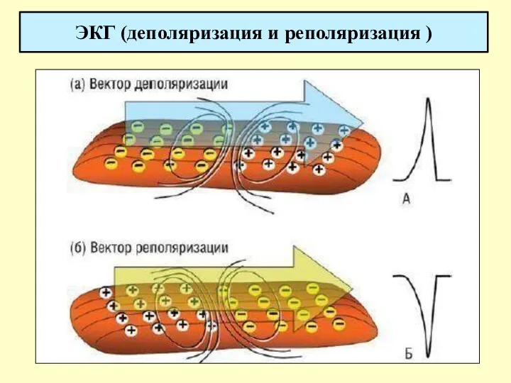 ЭКГ (деполяризация и реполяризация )