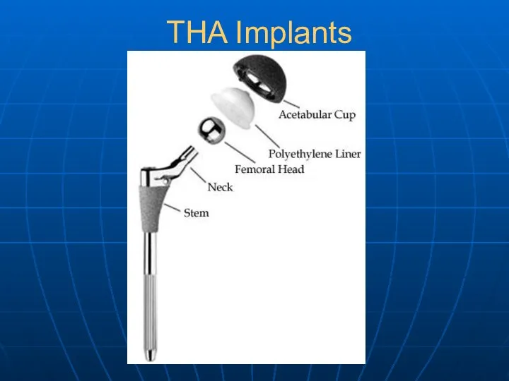 THA Implants