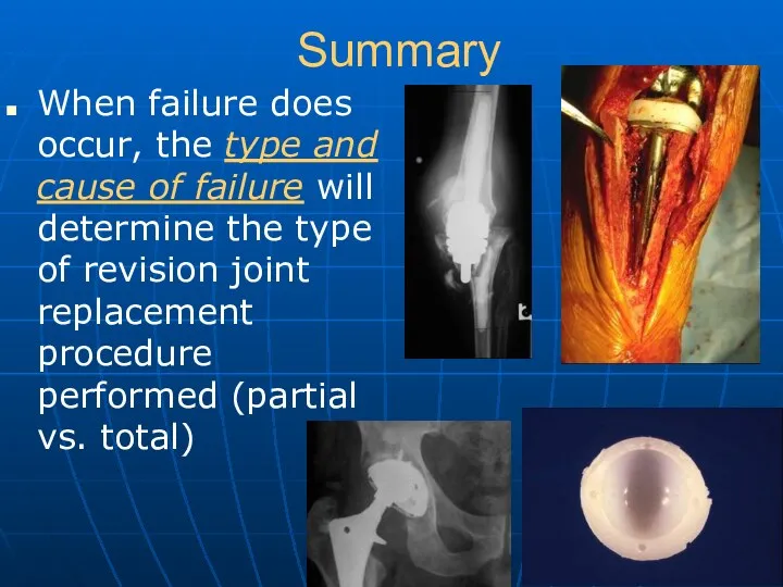 Summary When failure does occur, the type and cause of