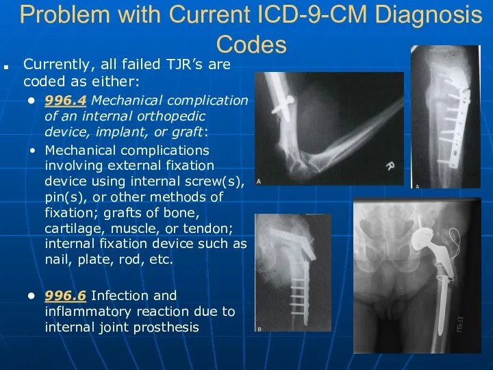 Problem with Current ICD-9-CM Diagnosis Codes Currently, all failed TJR’s