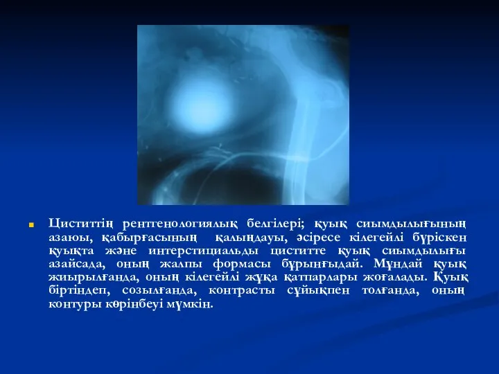 Циститтің рентгенологиялық белгілері; қуық сиымдылығының азаюы, қабырғасының қалыңдауы, әсіресе кілегейлі