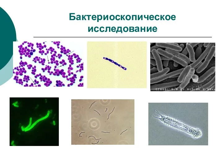 Бактериоскопическое исследование
