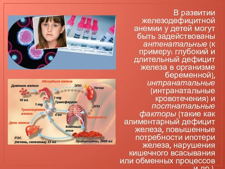 В развитии железодефицитной анемии у детей могут быть задействованы антенатальные (к примеру: глубокий
