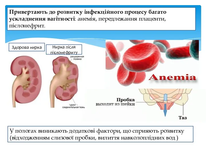 Привертають до розвитку інфекційного процесу багато ускладнення вагітності: анемія, передлежання