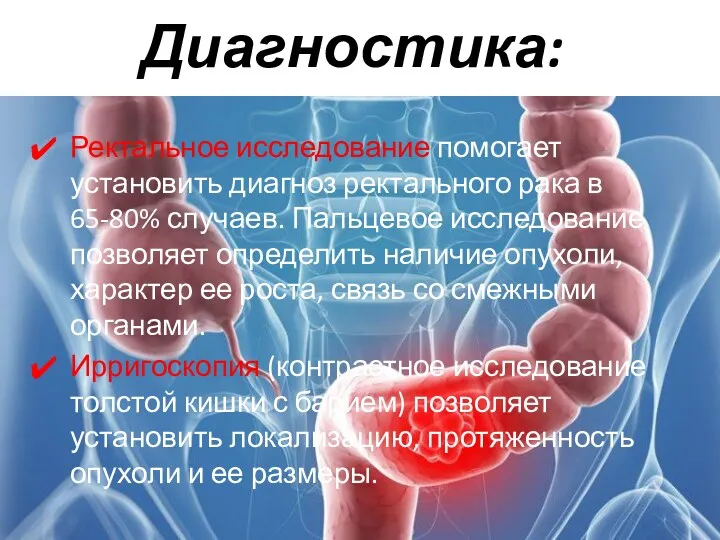 Диагностика: Ректальное исследование помогает установить диагноз ректального рака в 65-80%