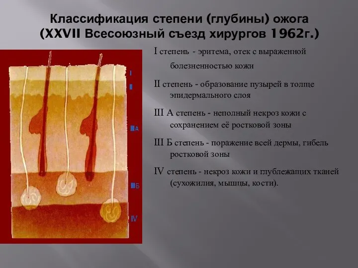 Классификация степени (глубины) ожога (XXVII Всесоюзный съезд хирургов 1962г.) I