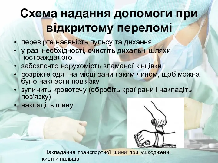 Схема надання допомоги при відкритому переломі перевірте наявність пульсу та