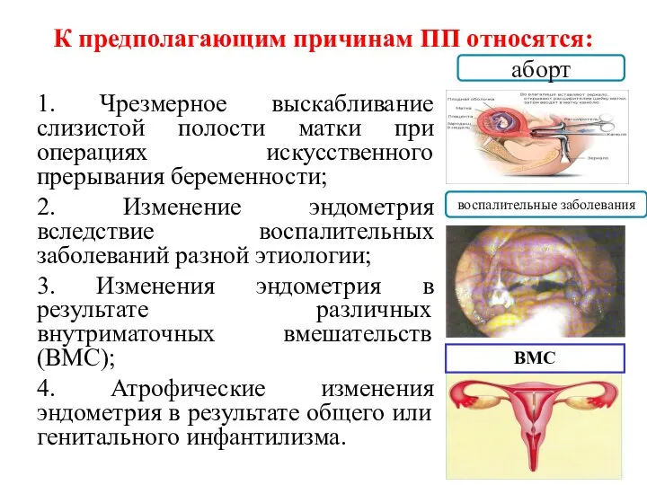 К предполагающим причинам ПП относятся: 1. Чрезмерное выскабливание слизистой полости матки при операциях