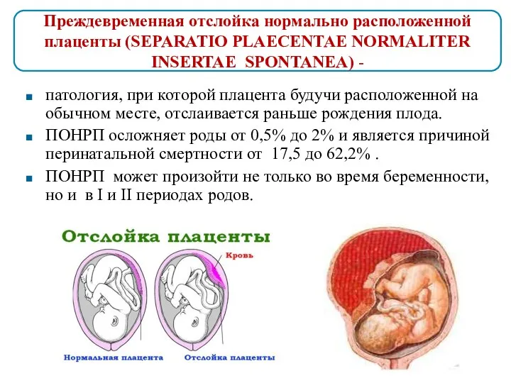 патология, при которой плацента будучи расположенной на обычном месте, отслаивается