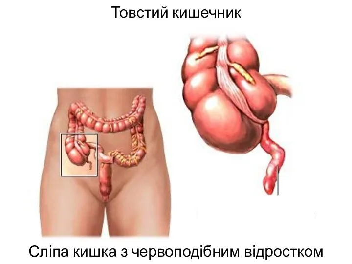 Товстий кишечник Сліпа кишка з червоподібним відростком