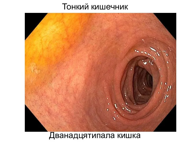 Тонкий кишечник Дванадцятипала кишка