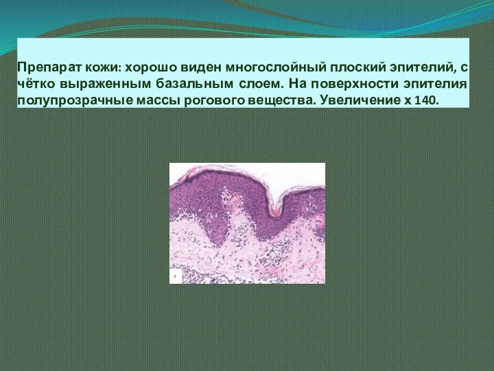 Препарат кожи: хорошо виден многослойный плоский эпителий, с чётко выраженным базальным слоем. На