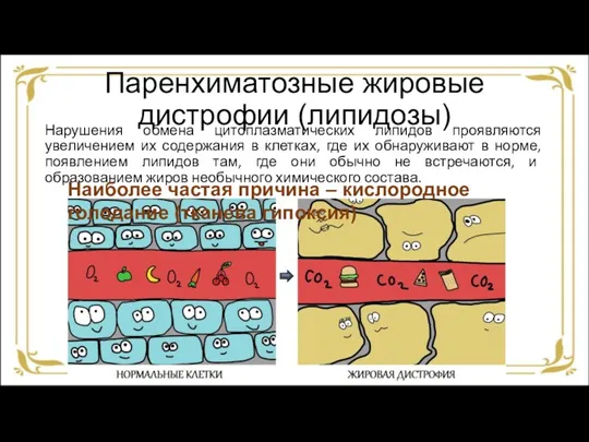 Паренхиматозные жировые дистрофии (липидозы) Нарушения обмена цитоплазматических липидов проявляются увеличением