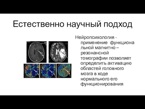 Естественно научный подход Нейропсихология - применение функциональной магнитно – резонансной