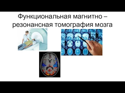 Функциональная магнитно –резонансная томография мозга