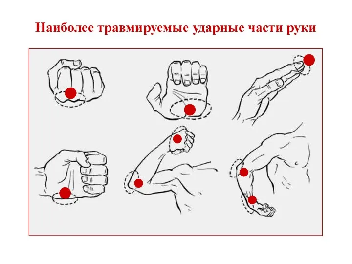 Наиболее травмируемые ударные части руки