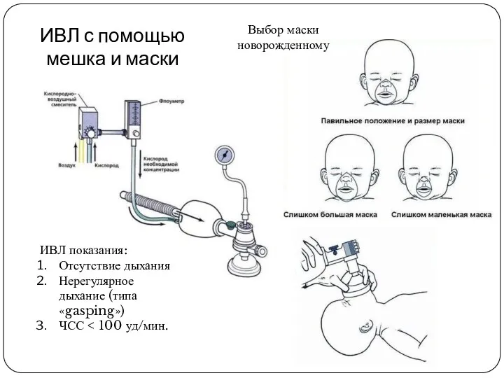 ИВЛ с помощью мешка и маски Выбор маски новорожденному ИВЛ показания: Отсутствие дыхания