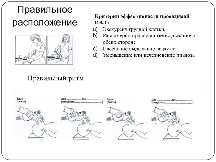 Правильное расположение Правильный ритм Критерии эффективности проводимой ИВЛ : Экскурсия