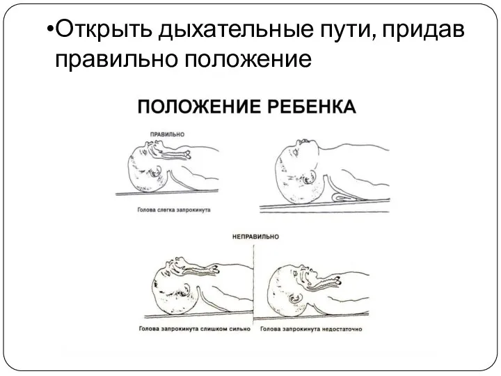 Открыть дыхательные пути, придав правильно положение