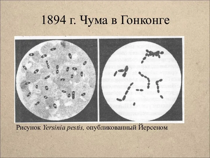 1894 г. Чума в Гонконге Рисунок Yersinia pestis, опубликованный Йерсеном