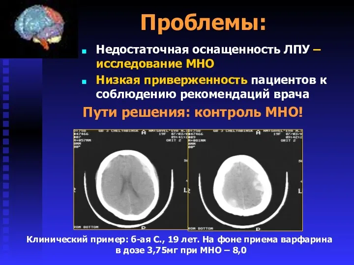 Проблемы: Недостаточная оснащенность ЛПУ – исследование МНО Низкая приверженность пациентов