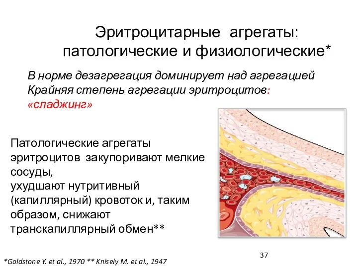 Эритроцитарные агрегаты: патологические и физиологические* *Goldstone Y. et al., 1970