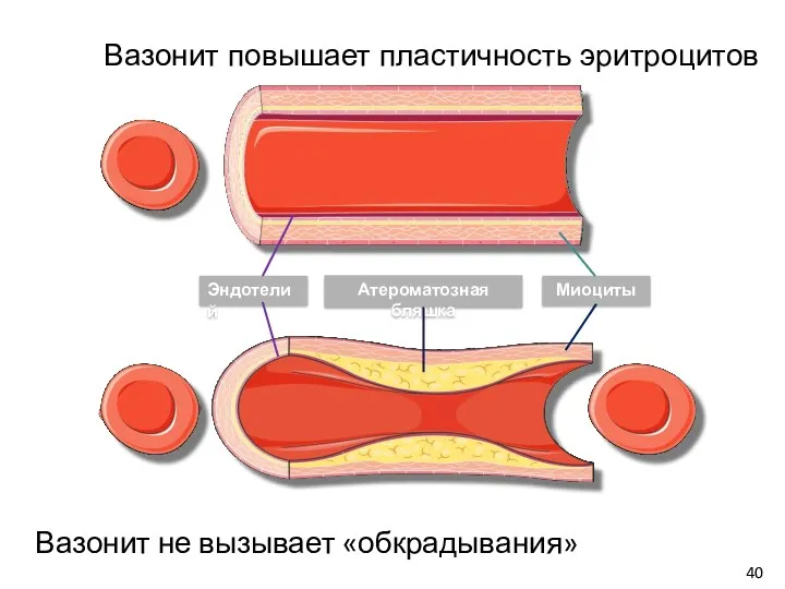 Миоциты Эндотелий Атероматозная бляшка Вазонит повышает пластичность эритроцитов Вазонит не вызывает «обкрадывания»