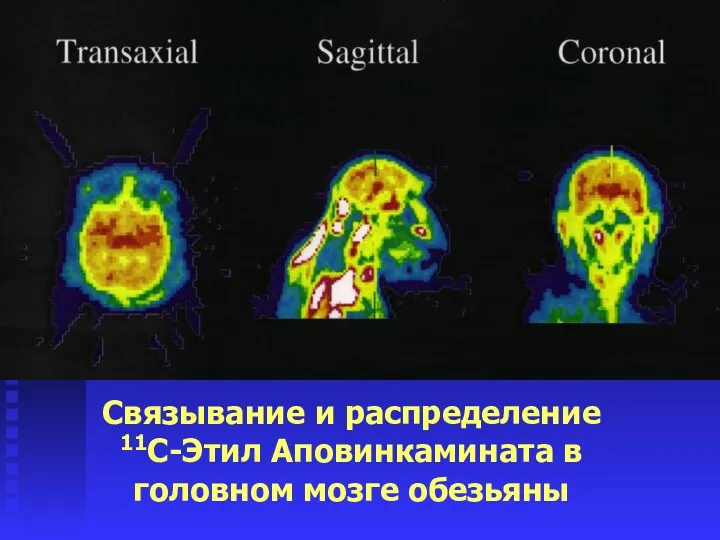 Связывание и распределение 11C-Этил Аповинкамината в головном мозге обезьяны