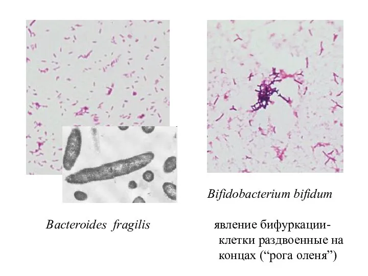 Bifidobacterium bifidum Bacteroides fragilis явление бифуркации- клетки раздвоенные на концах (“рога оленя”)
