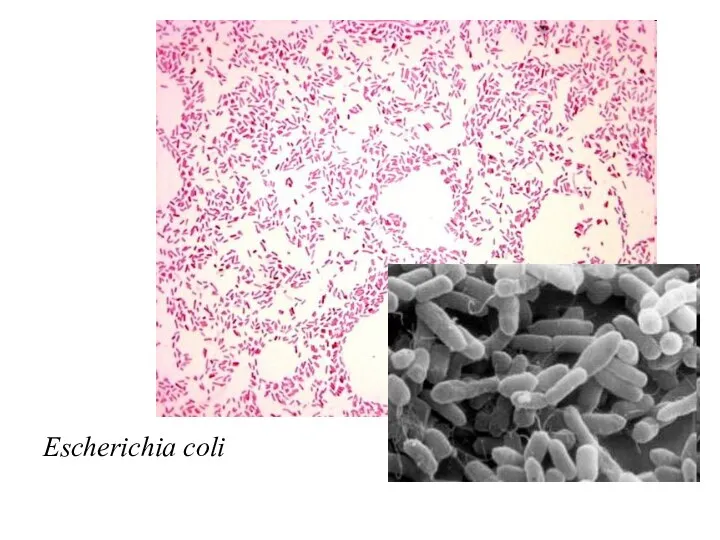 Escherichia coli