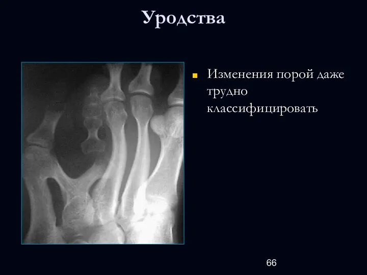 Уродства Изменения порой даже трудно классифицировать