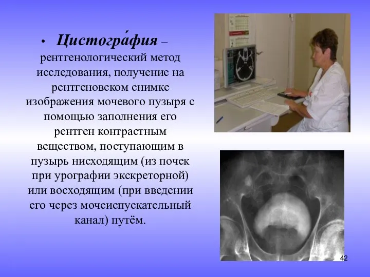 Цистогра́фия – рентгенологический метод исследования, получение на рентгеновском снимке изображения