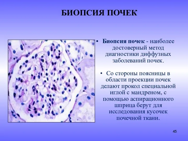 БИОПСИЯ ПОЧЕК Биопсия почек - наиболее достоверный метод диагностики диффузных