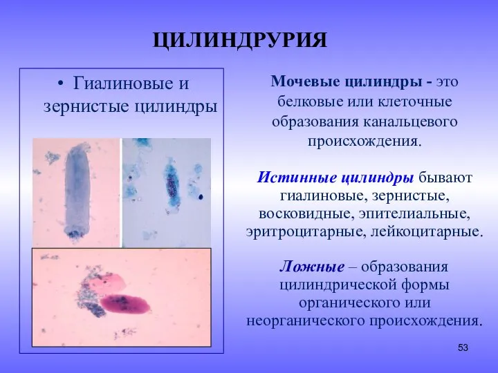 ЦИЛИНДРУРИЯ Гиалиновые и зернистые цилиндры Мочевые цилиндры - это белковые