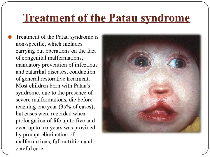 Treatment of the Patau syndrome Treatment of the Patau syndrome