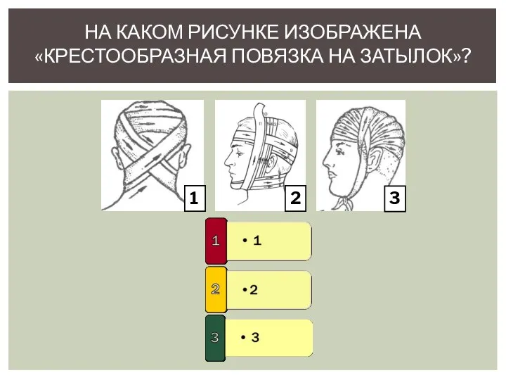 НА КАКОМ РИСУНКЕ ИЗОБРАЖЕНА «КРЕСТООБРАЗНАЯ ПОВЯЗКА НА ЗАТЫЛОК»? 1 2 3