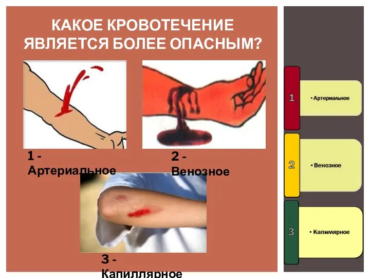 КАКОЕ КРОВОТЕЧЕНИЕ ЯВЛЯЕТСЯ БОЛЕЕ ОПАСНЫМ? 1 - Артериальное 2 - Венозное 3 - Капиллярное