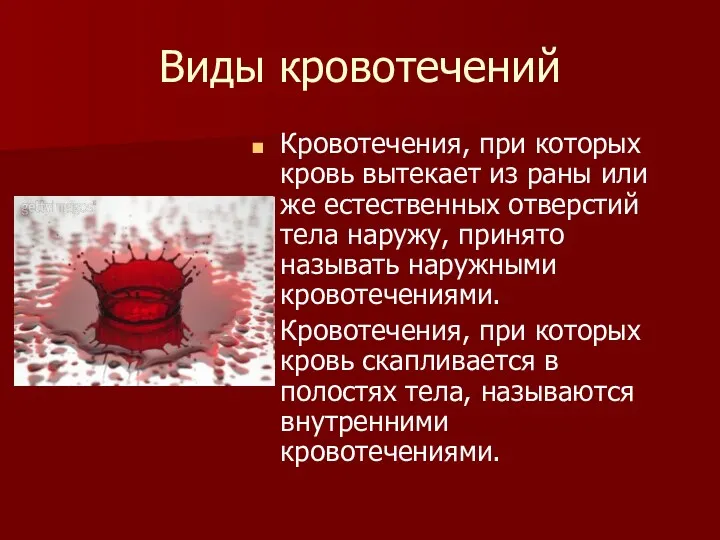 Виды кровотечений Кровотечения, при которых кровь вытекает из раны или