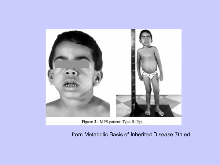 from Metabolic Basis of Inherited Disease 7th ed