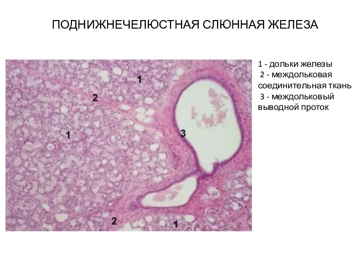 ПОДНИЖНЕЧЕЛЮСТНАЯ СЛЮННАЯ ЖЕЛЕЗА 1 - дольки железы 2 - междольковая