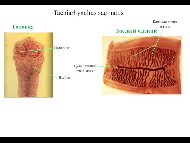 Taeniarhynchus saginatus Присоски Шейка Головка Зрелый членик