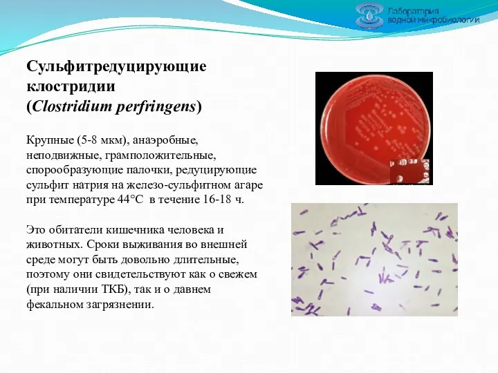 Сульфитредуцирующие клостридии (Clostridium perfringens) Крупные (5-8 мкм), анаэробные, неподвижные, грамположительные, спорообразующие палочки, редуцирующие