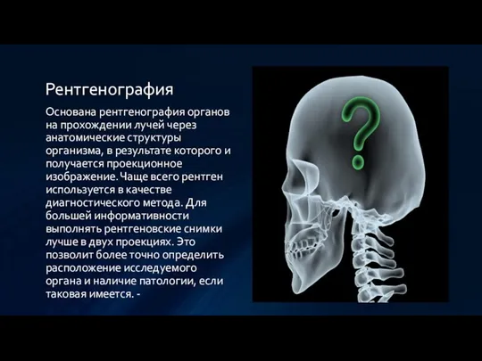 Рентгенография Основана рентгенография органов на прохождении лучей через анатомические структуры организма, в результате